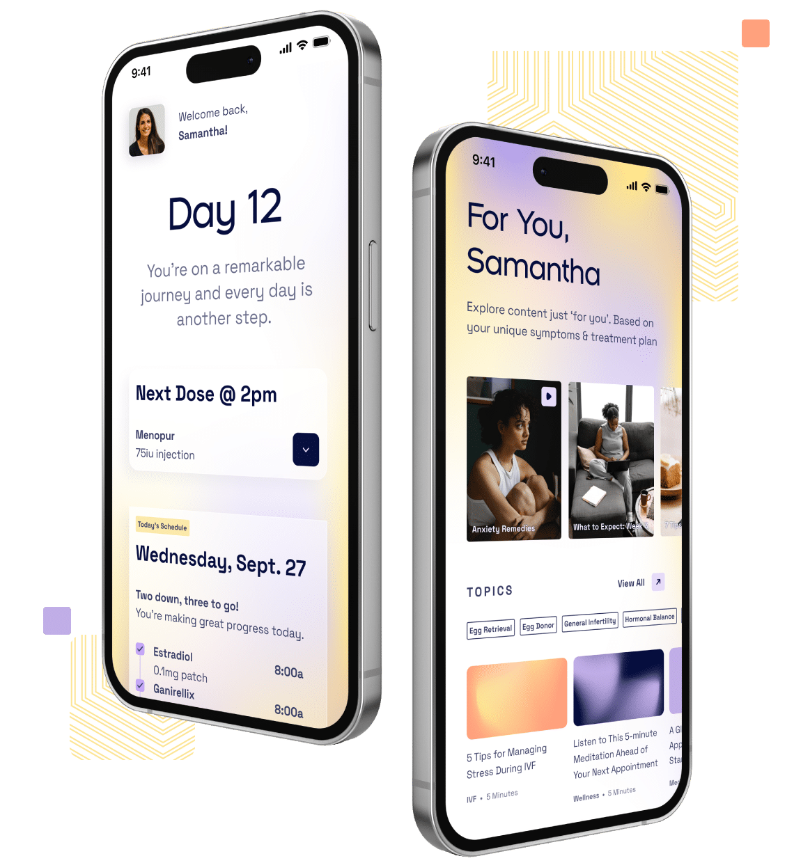Two iPhone 14 screens showing the home screen and content screens from the Pixel app.
